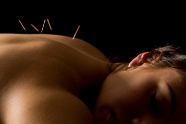 Traditional Chinese Acupuncture